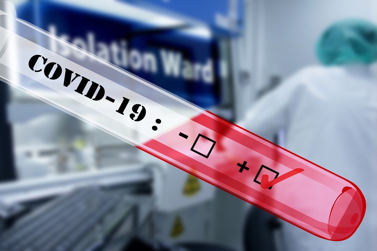 Ci riprenderemo dalla pandemia, ma non esiste un'ora X in cui tutto sarà finito