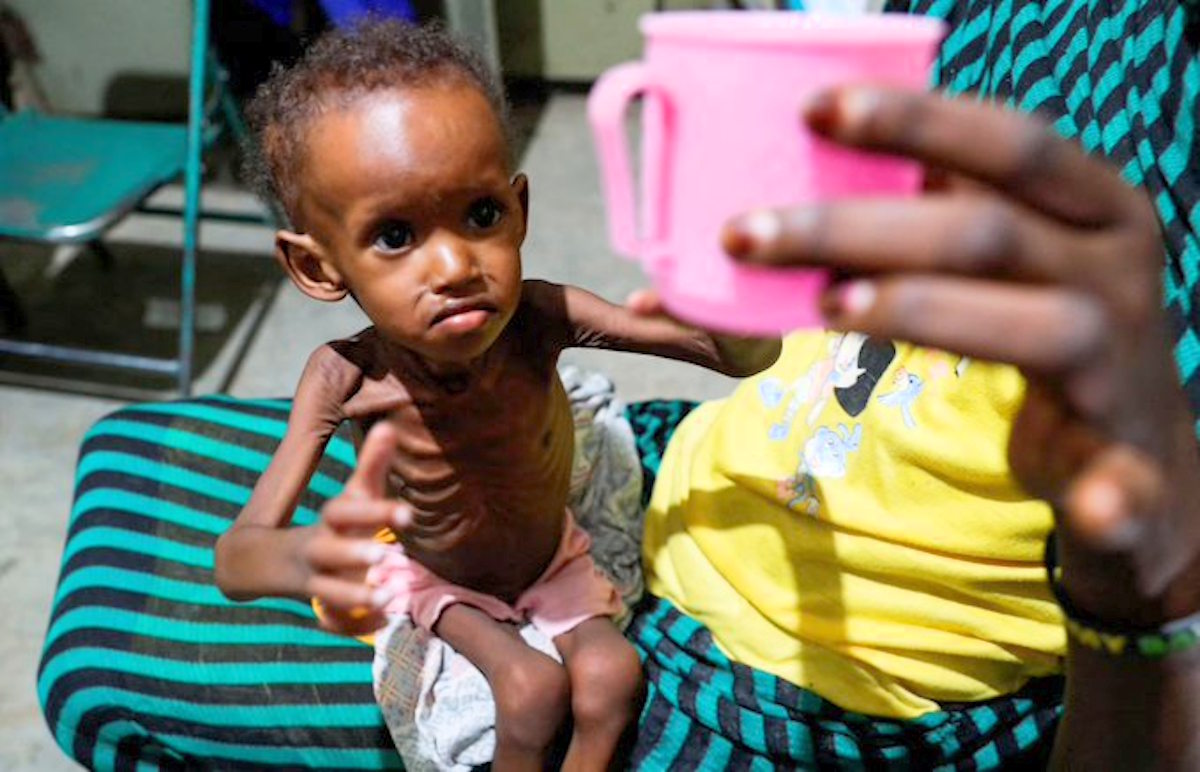 Sudan, emergenza sanitaria senza precedenti: guerra, epidemie e fame aggravano la crisi